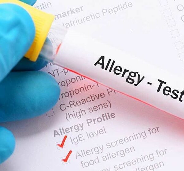 Dr Ikbel Khalfallah Pediatric pulmonologist Dubai, Allergist Dubai