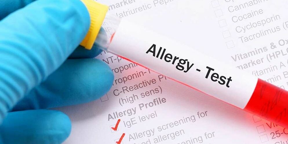 Allergy-Testing-Dubai