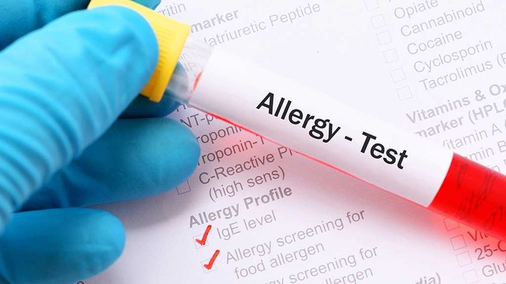 Allergy-Testing-Dubai