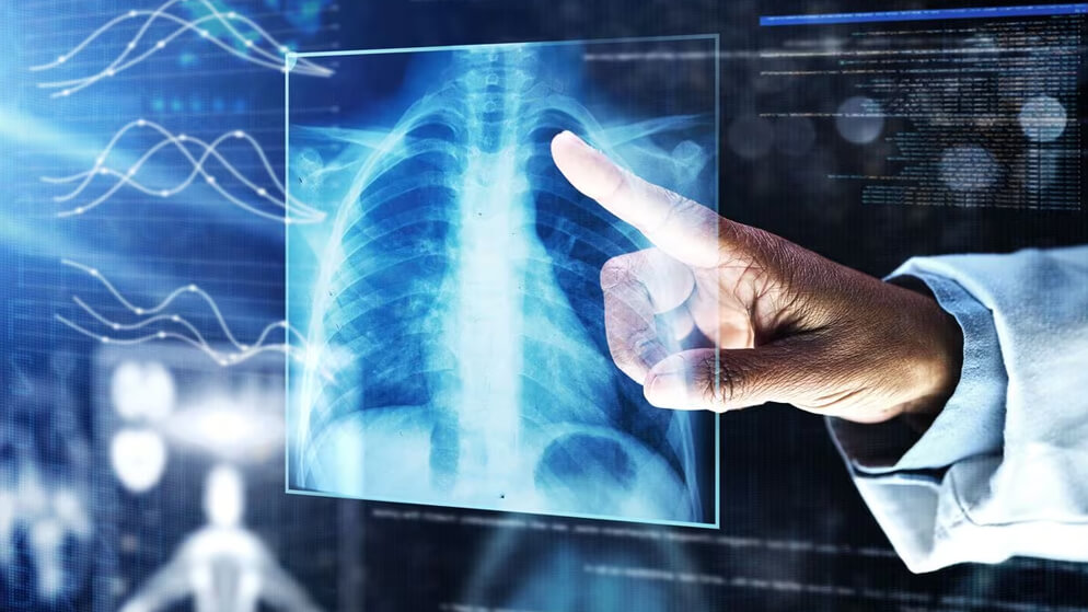 allergist-Dubai-Pulmonologist