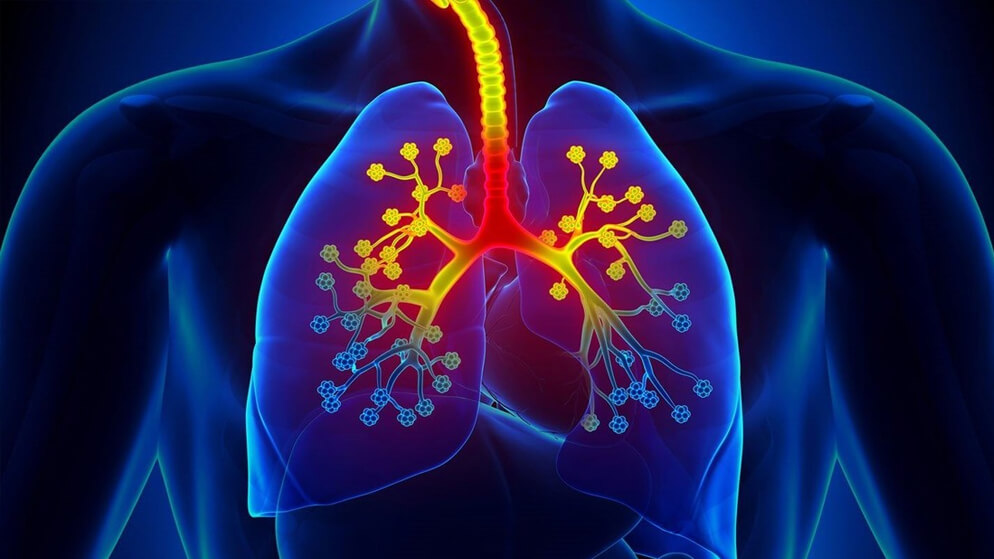 Bronchial-Asthma-Dubai